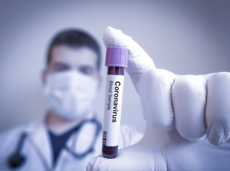 O nouă creștere alarmantă a numărului de cazuri de coronavirus în România. Au fost înregistrate 30 de decese într-o singură zi