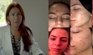 Acuzații grave la adresa așa-zis-ului doctor dermatolog, Marinescu Ioana Lavinia