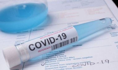 Zece pompieri de la Detaşamentul Cernavodă, infectaţi cu COVID-19