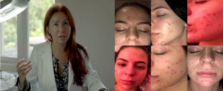 Acuzații grave la adresa așa-zis-ului doctor dermatolog, Marinescu Ioana Lavinia