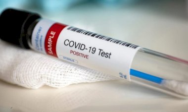 România atinge un nou record de cazuri de coronavirus: 799 de noi îmbolnăviri în ultimele 24 de ore