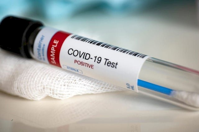 România atinge un nou record de cazuri de coronavirus: 799 de noi îmbolnăviri în ultimele 24 de ore