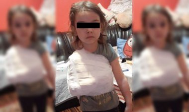 Medic ortoped acuzat că i-a pus ghipsul peste tricou unei fetițe de 4 ani