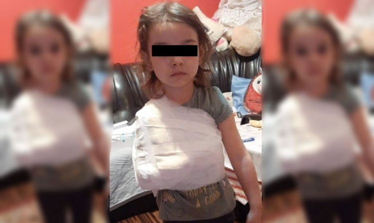 Medic ortoped acuzat că i-a pus ghipsul peste tricou unei fetițe de 4 ani
